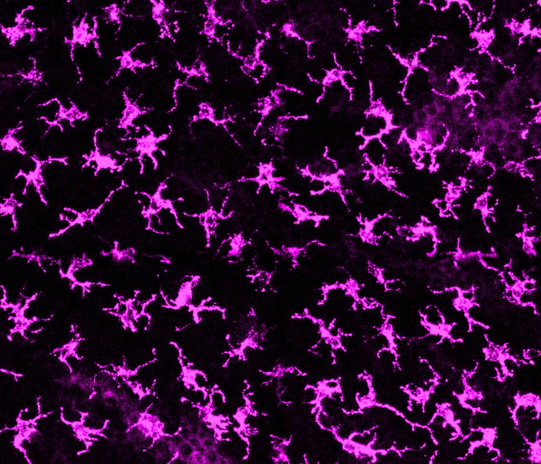 Skin-Resident Immune Cells Drive Neuropathic Pain in Diabetes