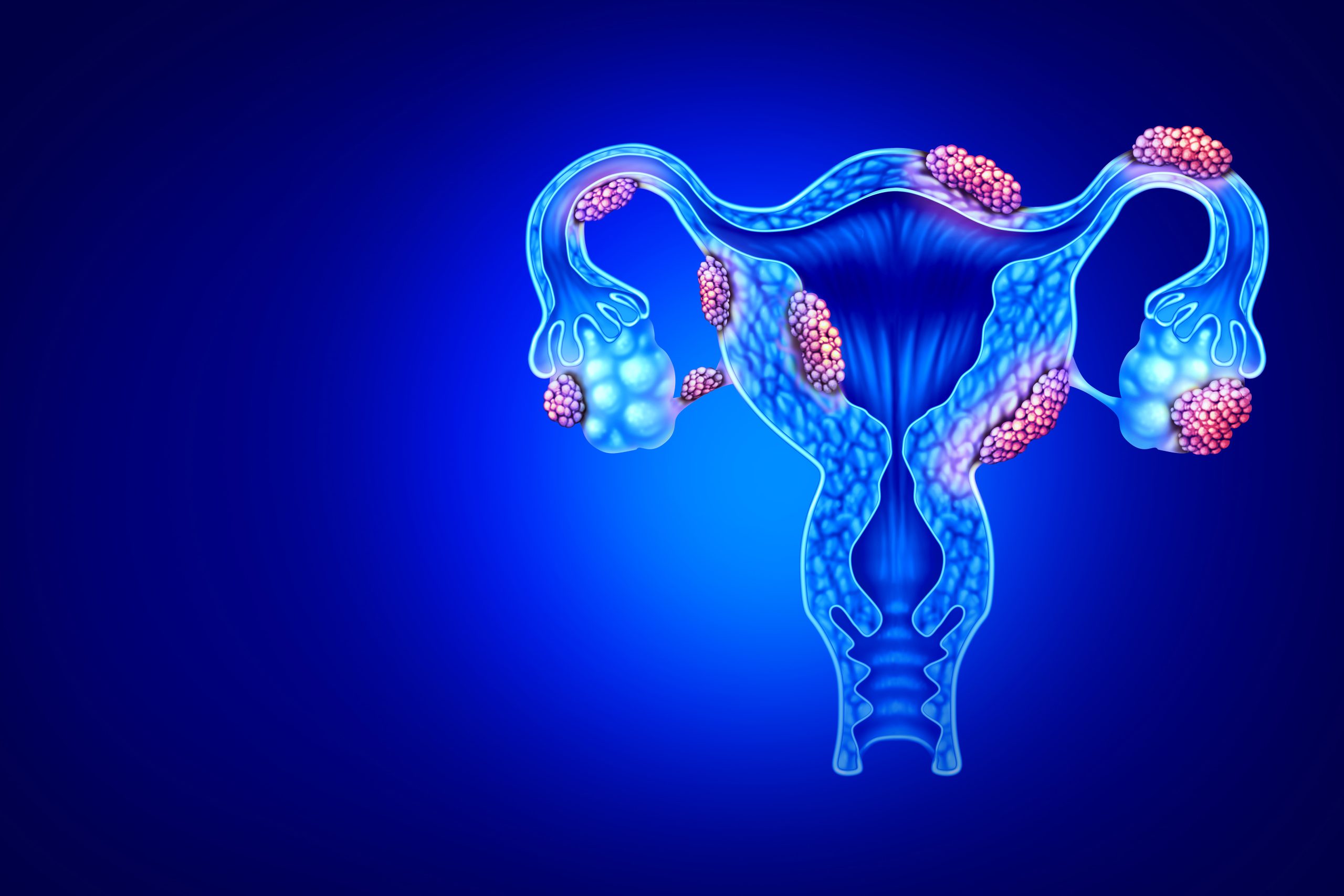 Novel Stem Cell Platform Improves Study of Endometriosis
