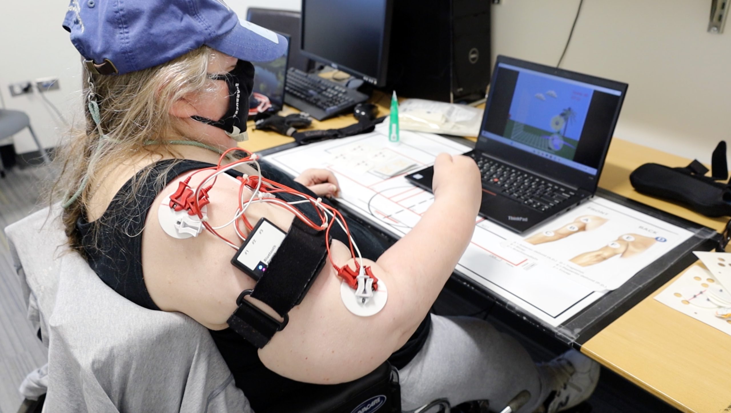 Improving Stroke Care and Innovation