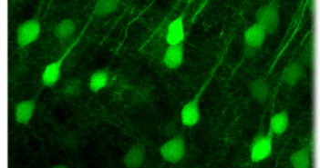 Neon Exposes Hidden ALS Cells, Helps Scientists Study Why They Die