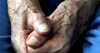 Scientists Reveal Protein’s Role as More Than Adhesion Molecule in Skin Development