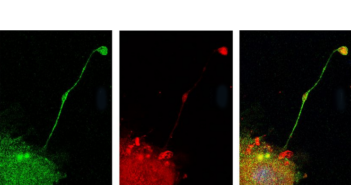 Platelet Production Affected by Key Protein