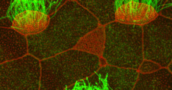 Protein Marks Vital Component in Creation of Multi-Ciliated Cells