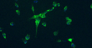 Nanodiamonds Used to Improve Bone Growth