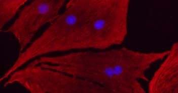 Iron May be at Heart of Cancer Drug’s Cardiotoxicity Effect