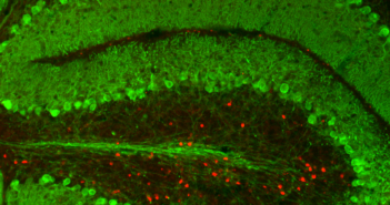 Scientist Uncovers Selective Cell Death in Ataxia