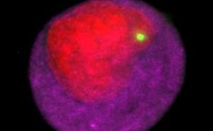 Scientists Discover Cancer-Associated Cells