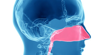 Study Finds Sex-Specific Differences in Chronic Rhinosinusitis