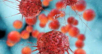 Skin Gel Stops Breast Cancer Growth Without Dangerous Side Effects