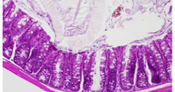Regulation of Immune Response in the Gut
