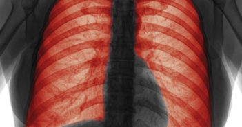 Exploring How Heart and Lung Diseases Evolve As We Age