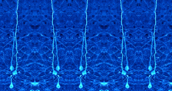 ALS Therapy Should Target Brain, Not Just Spine