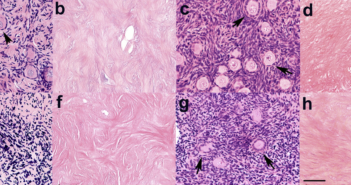 Ovary Transplantation Shows Promise for Restoring Cancer Survivor Fertility