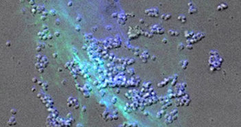 Exploring Bacterial Competition in Reproductive Tract Infections
