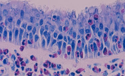 Scientists Advancing Sinus Research That Affects Millions
