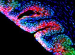 Bone Marrow Cells Used in Bladder Regeneration