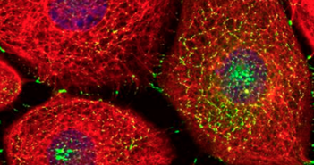 Protein that Helps Cells Stick Together May Explain Heart Disease Development