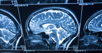 Inter-Sensory Processing Uncovered