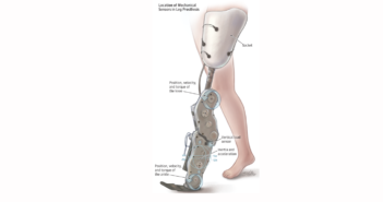 Building a Better Prosthetic Leg for Amputees