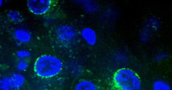 Uncovering How Herpes Viruses Invade the Nervous System