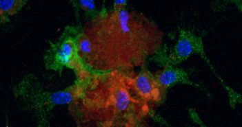 Understanding Cellular Interactions During Heart Repair