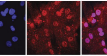 Decoding Signaling Pathways that Lead to Scar Tissue
