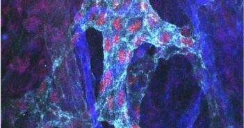 Proposing a Novel Cause for Obesity