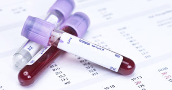 Continuous Glucose Monitoring May Help Reduce Hypoglycemia
