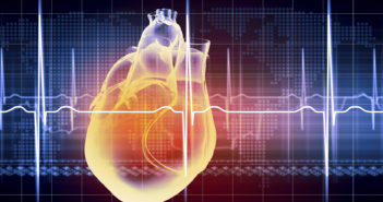 Noninvasive Imaging Predicts Risk of Heart Transplant Rejection