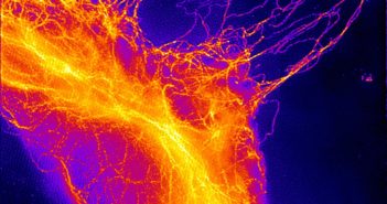 Investigating the Molecular Roots of Lung Disease