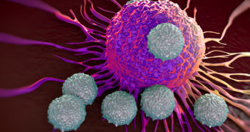 Identifying Cancer Biomarkers for Immunotherapy Response