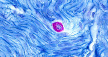 Chemotherapy Drug Shows Promise in Treating Everyday Allergies