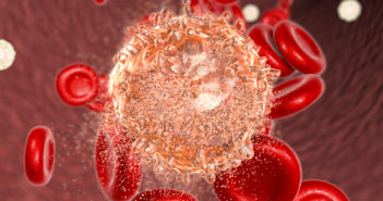 Genetic ‘Neighborhoods’ Fuel Leukemia