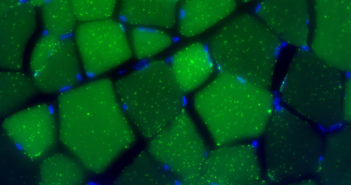 Increased Cell Recycling Could Treat Aging-Related Conditions Fasting for 24 hours induced dramatic formation of autophagic vesicles (green dots, labeled by a marker protein LC3 tagged with the green fluorescent protein) in skeletal muscle. Blue indicates DAPI-stained nuclei.