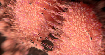 New Regulator of Prostate Cancer Metastasis Discovered