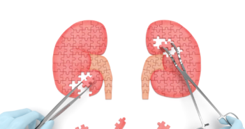 Mitochondrial Dysfunction Contributes to Kidney Disease gettyimages-485756966