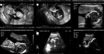 Refining Standards of Maternal-Fetal Care