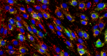 Cellular Mechanism Protects Organs During Iron Deficiency
