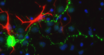 Basic Science: The Foundation for an ALS Cure