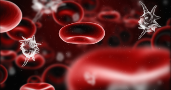 Prompt Treatment Improves Outcomes in Pediatric Sepsis