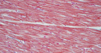 Mechanisms Driving Inherited Heart Disease