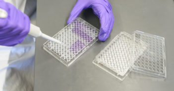 Northwestern Receives $5.8 Million Grant to Advance Kidney Research