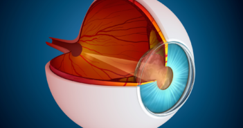 Subclinical Macular Degeneration Requires Monitoring
