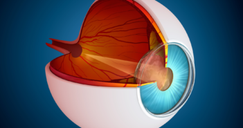 Newly Formed Blood Vessels May Contribute to Eye Disease