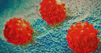 New Chemotherapy Alternative for Lymphoma