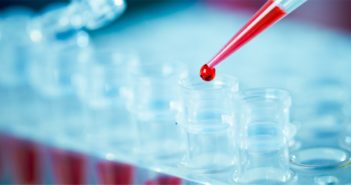 Blood Test Predicts Response to Immunotherapy