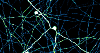 Origin of Neuromodulator in the Retina Pinpointed