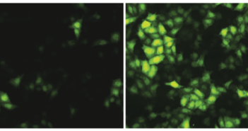 Ebola-Fighting Protein Discovered