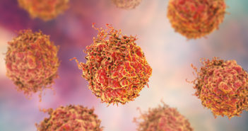 Experimental Drug May Reduce Cancer Growth and Progression