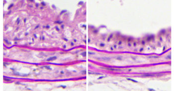 Student Investigates Role of Microbiome in Arterial Injury Response